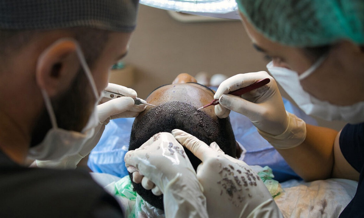 Top 8 Hair Transplant Surgeons in Indore with Global Recognition
